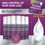Women&acute;s Minoxidil by Perrigo Hair Regrowth Treatment 2.11 fl oz, 6-pack
